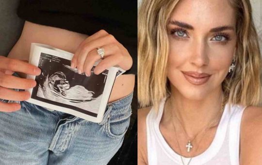 chiara ferragni ecografia-Solospettacolo